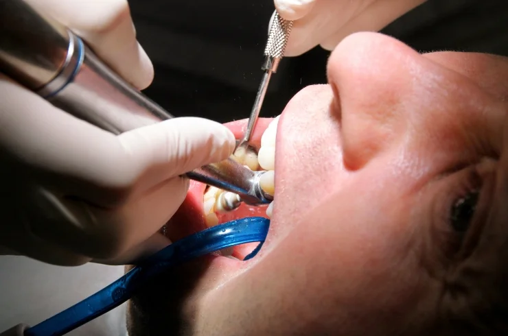 Routine Dental Check-ups-