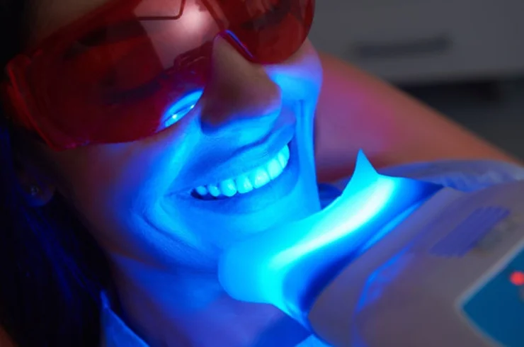 Teeth Whitening 
