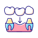 dental-crown